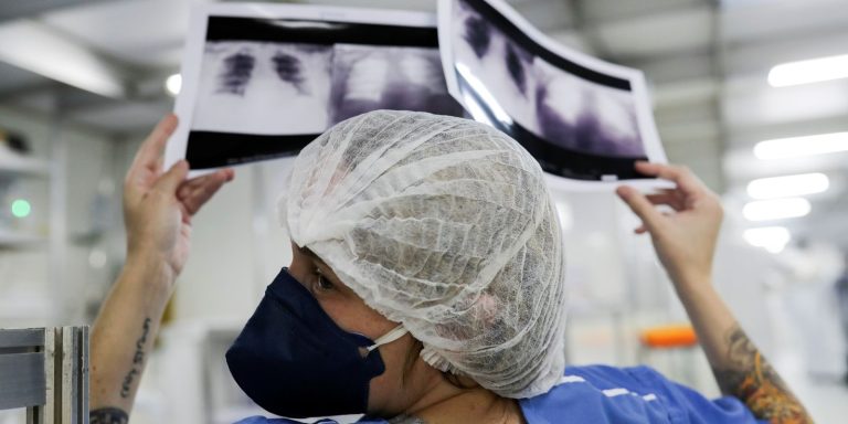 Diagnóstico tardio dá poucas chances de cura para o câncer de pulmão Câncer de pulmão: 15% dos casos acontecem em não fumantes