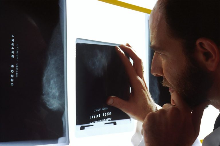 Carreta de saúde da mulher leva mamografias e exames especializados a Remígio, na Paraíba Profissional de saúde analisando mamografias, imagem ilustrativa